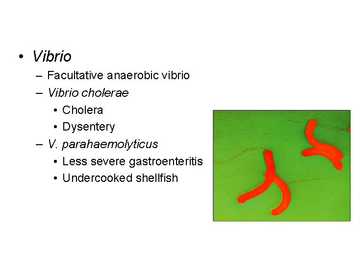  • Vibrio – Facultative anaerobic vibrio – Vibrio cholerae • Cholera • Dysentery