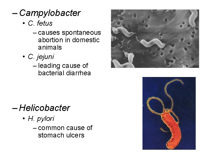 – Campylobacter • C. fetus – causes spontaneous abortion in domestic animals • C.