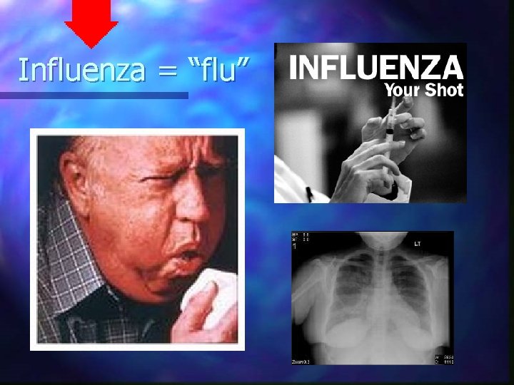 Influenza = “flu” 