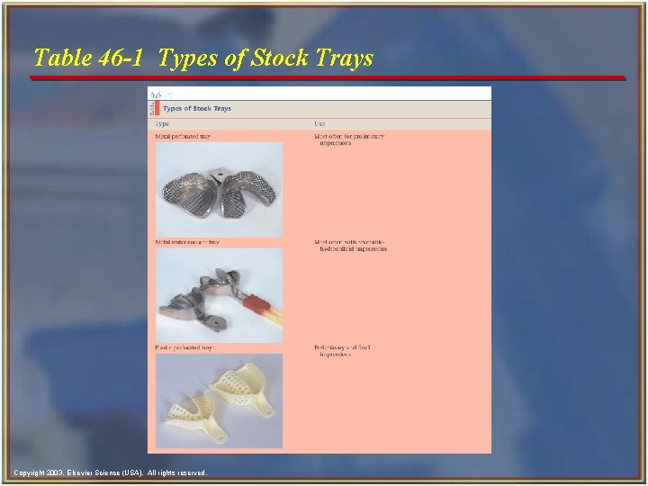 Table 46 -1 Types of Stock Trays Copyright 2003, Elsevier Science (USA). All rights