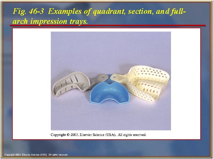 Fig. 46 -3 Examples of quadrant, section, and fullarch impression trays. Copyright 2003, Elsevier