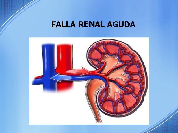 FALLA RENAL AGUDA 