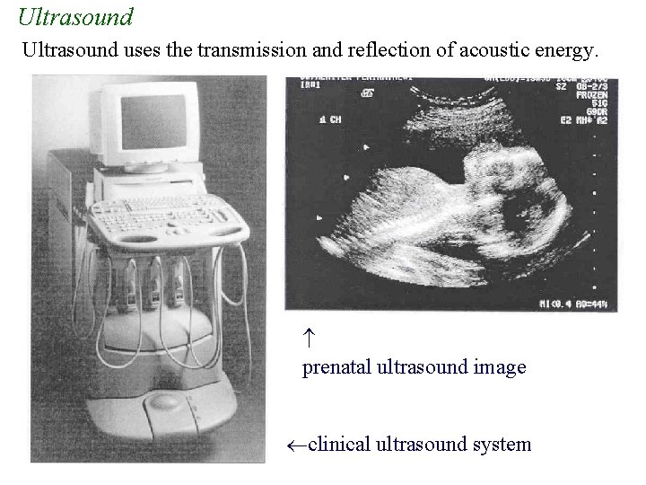 Ultrasound uses the transmission and reflection of acoustic energy. prenatal ultrasound image clinical ultrasound