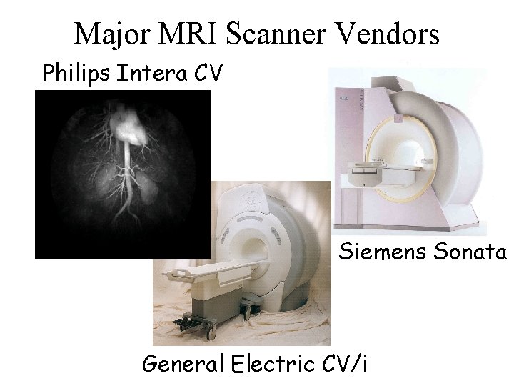 Major MRI Scanner Vendors Philips Intera CV Siemens Sonata General Electric CV/i 