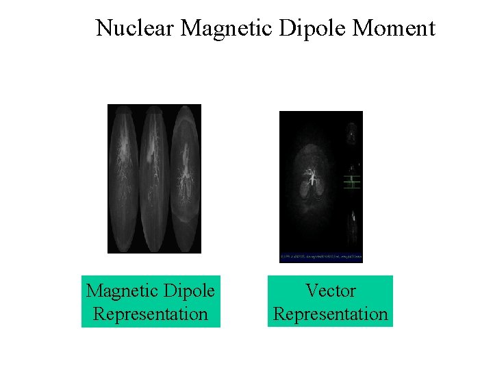 Nuclear Magnetic Dipole Moment Magnetic Dipole Representation Vector Representation 