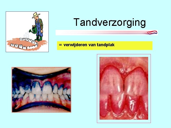 Tandverzorging = verwijderen van tandplak 