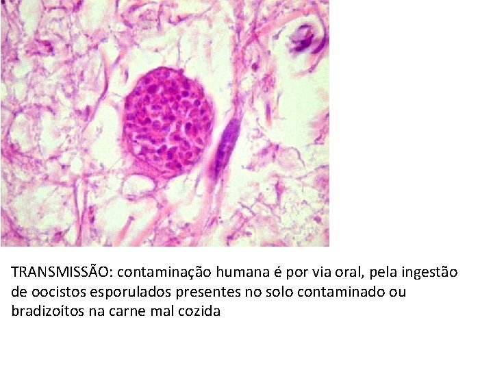 TRANSMISSÃO: contaminação humana é por via oral, pela ingestão de oocistos esporulados presentes no