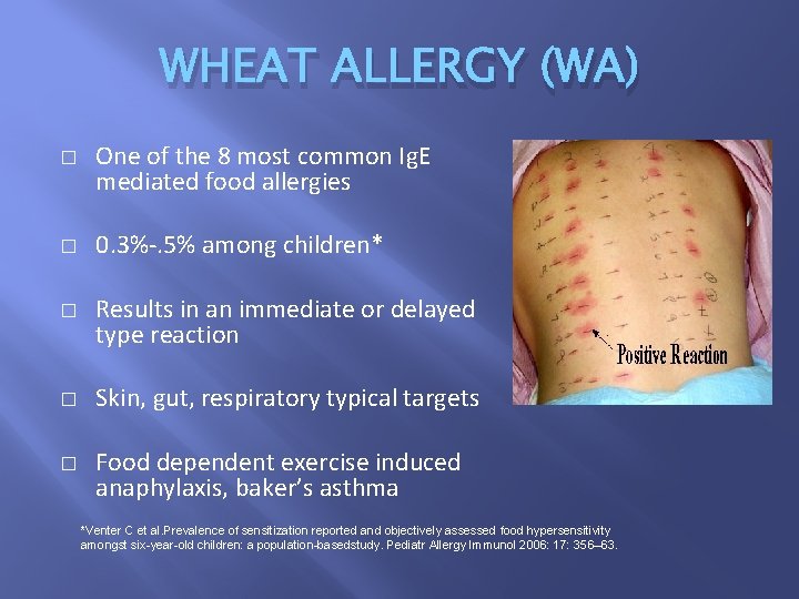 WHEAT ALLERGY (WA) � � � One of the 8 most common Ig. E