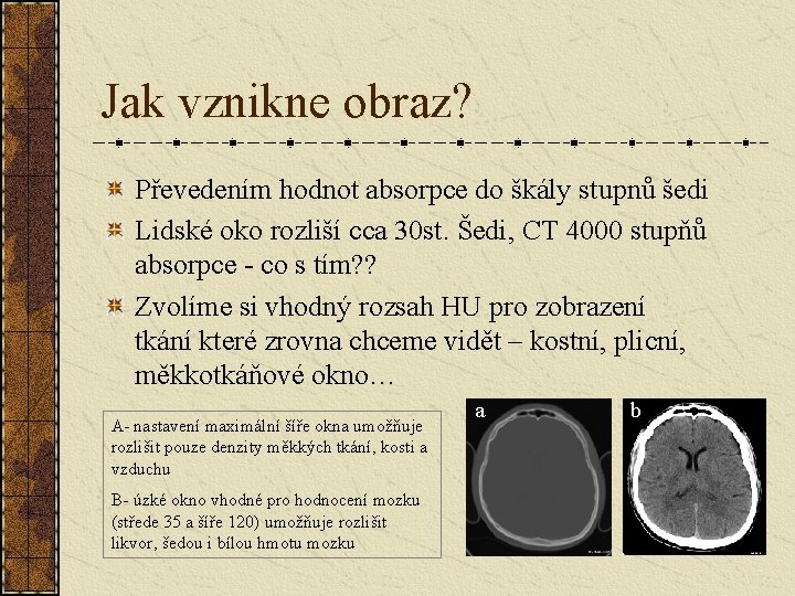 Jak vznikne obraz? Převedením hodnot absorpce do škály stupnů šedi Lidské oko rozliší cca Jak vznikne obraz? Převedením hodnot absorpce do škály stupnů šedi Lidské oko rozliší cca
