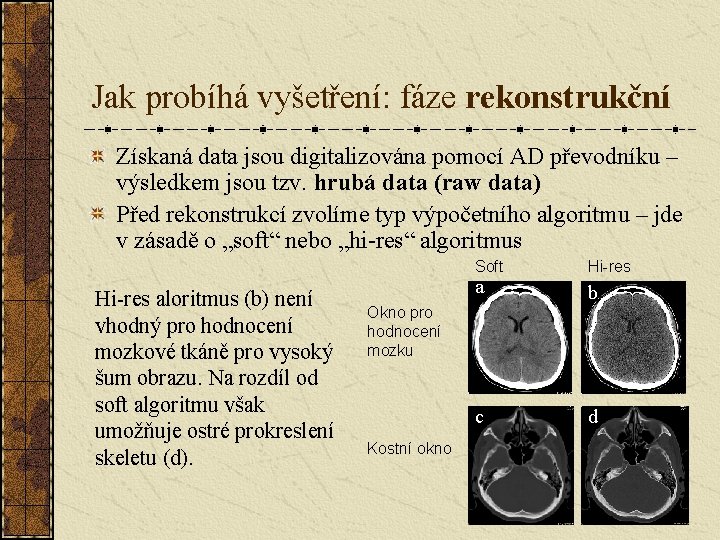 Jak probíhá vyšetření: fáze rekonstrukční Získaná data jsou digitalizována pomocí AD převodníku – výsledkem Jak probíhá vyšetření: fáze rekonstrukční Získaná data jsou digitalizována pomocí AD převodníku – výsledkem