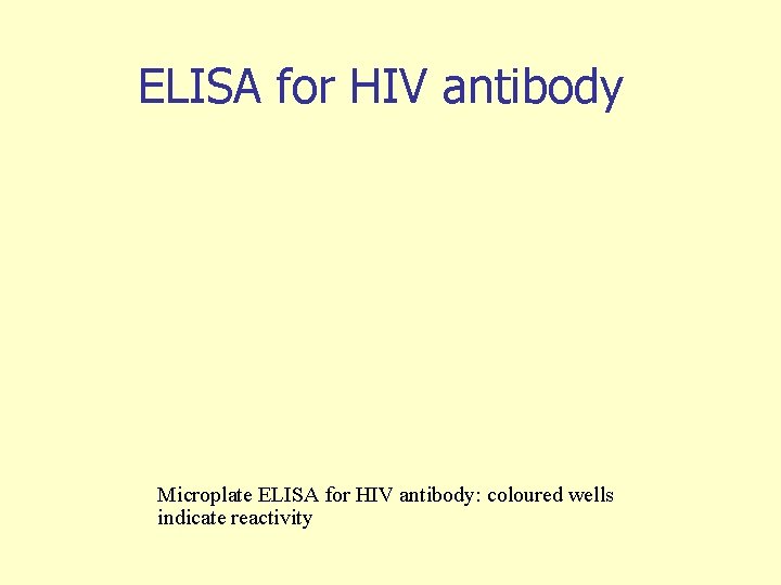 ELISA for HIV antibody Microplate ELISA for HIV antibody: coloured wells indicate reactivity 