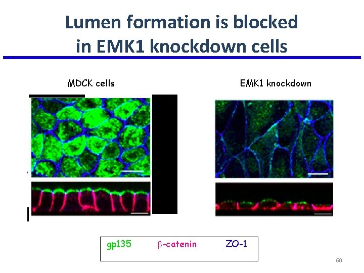 Lumen formation is blocked in EMK 1 knockdown cells MDCK cells gp 135 EMK