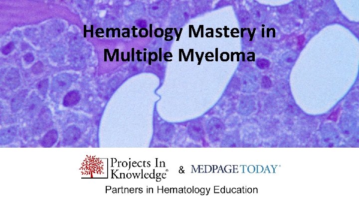 Hematology Mastery in Multiple Myeloma 