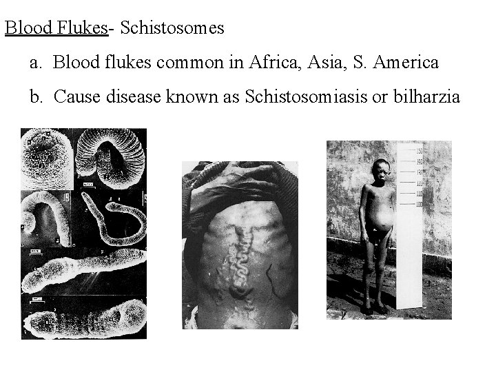 Blood Flukes- Schistosomes a. Blood flukes common in Africa, Asia, S. America b. Cause