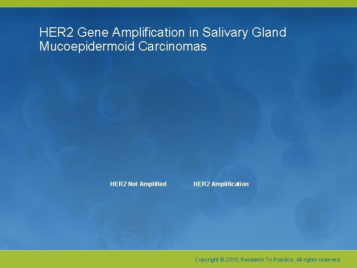 HER 2 Gene Amplification in Salivary Gland Mucoepidermoid Carcinomas HER 2 Not Amplified HER