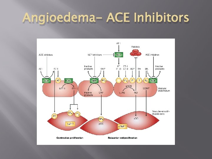 Angioedema- ACE Inhibitors 