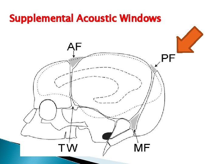 Supplemental Acoustic Windows 