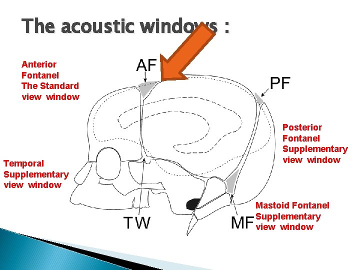 The acoustic windows : Anterior Fontanel The Standard view window Temporal Supplementary view window