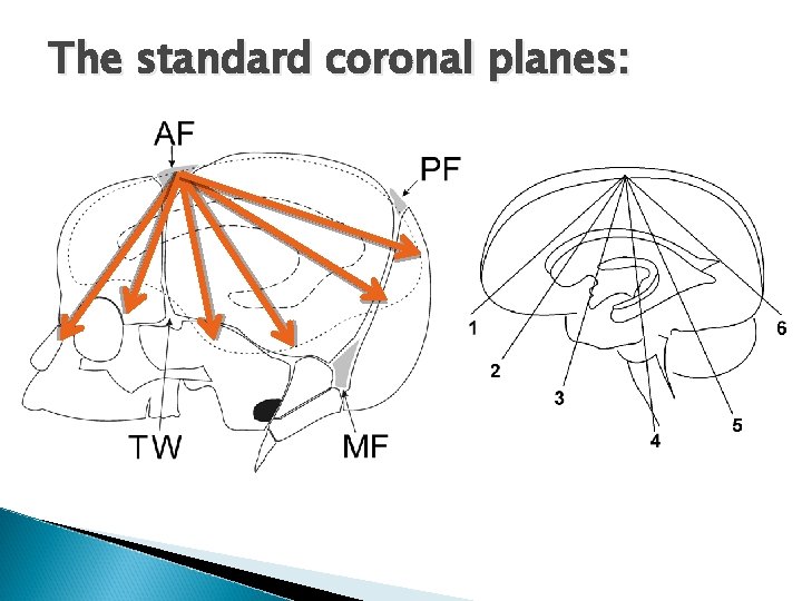 The standard coronal planes: 