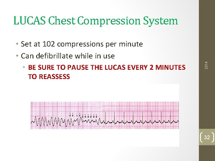 LUCAS Chest Compression System • BE SURE TO PAUSE THE LUCAS EVERY 2 MINUTES