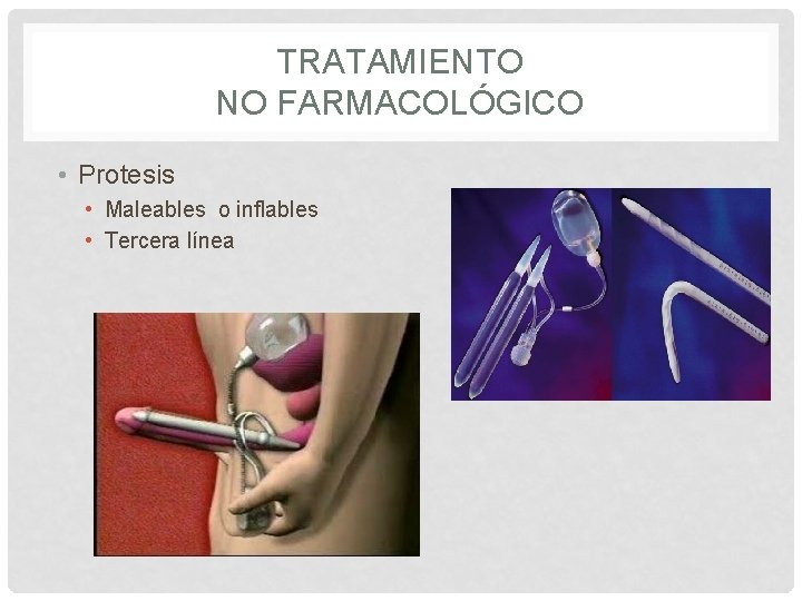 TRATAMIENTO NO FARMACOLÓGICO • Protesis • Maleables o inflables • Tercera línea 