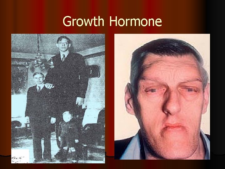 Growth Hormone 