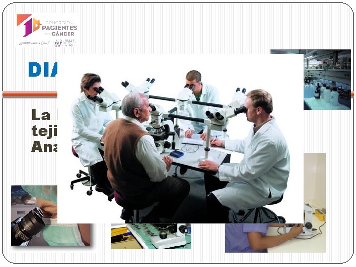 DIAGNÓSTICO La BIOPSIA de un ganglio o un tejido infiltrado… y el estudio Anatomopatológico