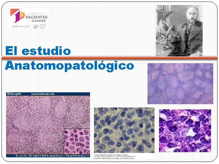 El estudio Anatomopatológico 