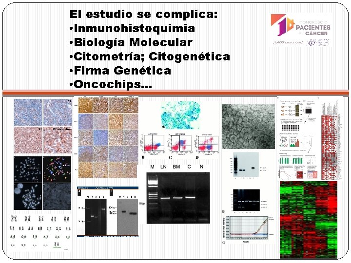 El estudio se complica: • Inmunohistoquimia • Biología Molecular • Citometría; Citogenética • Firma