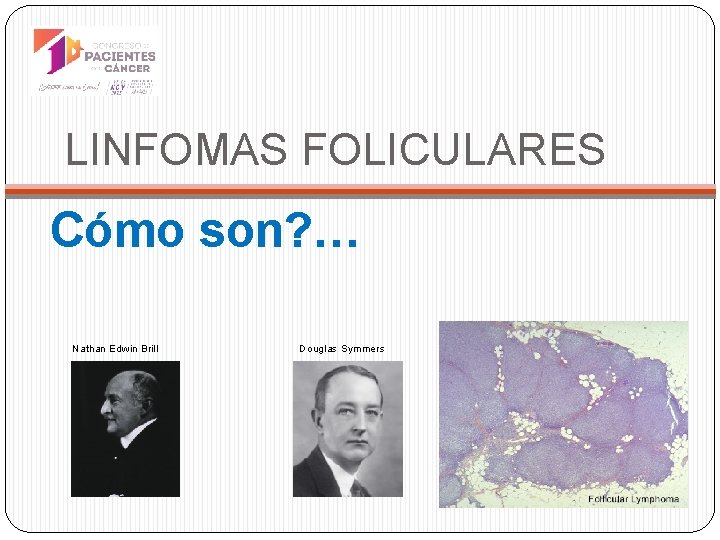 LINFOMAS FOLICULARES Cómo son? … Nathan Edwin Brill Douglas Symmers 