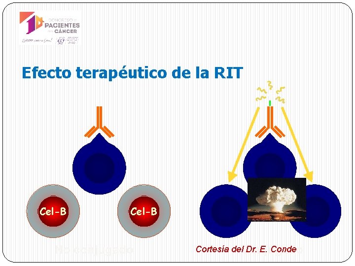 Efecto terapéutico de la RIT Y 90 Cel-B CD 20 Cel-B No conjugado Cel-B