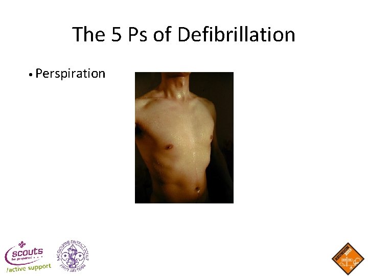 The 5 Ps of Defibrillation • Perspiration The 5 Ps of Defibrillation • Perspiration
