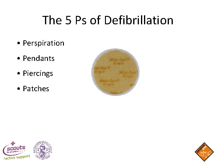 The 5 Ps of Defibrillation • Perspiration • Pendants • Piercings • Patches The 5 Ps of Defibrillation • Perspiration • Pendants • Piercings • Patches