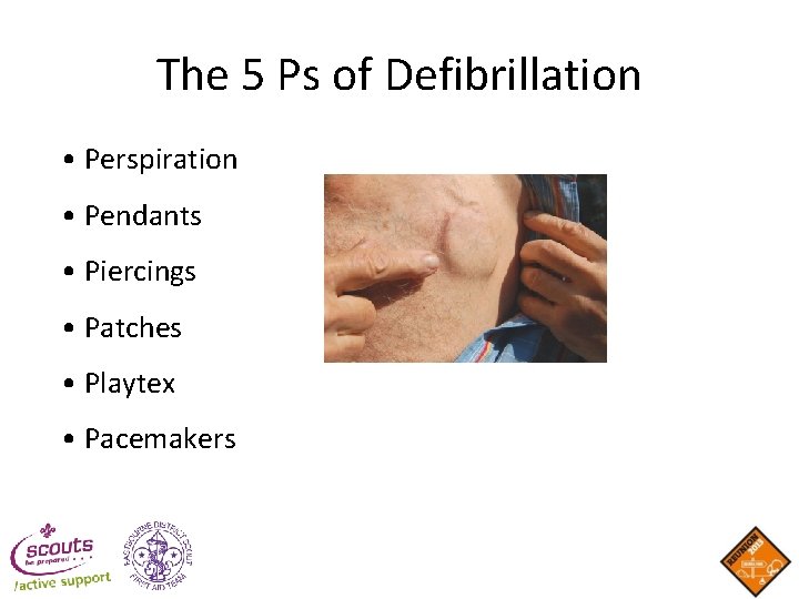 The 5 Ps of Defibrillation • Perspiration • Pendants • Piercings • Patches • The 5 Ps of Defibrillation • Perspiration • Pendants • Piercings • Patches •