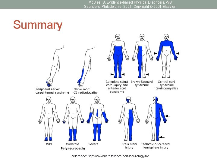 Mc. Gee, S, Evidence-based Physical Diagnosis, WB Saunders, Philadelphia, 2001. Copyright © 2001 Elsevier.