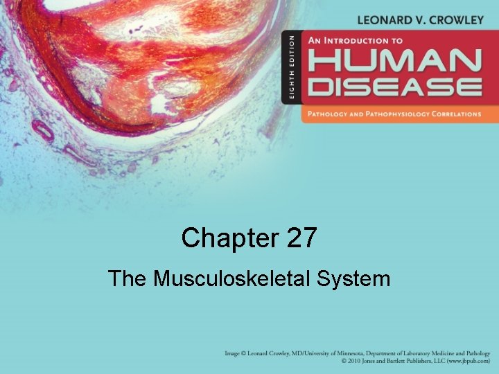 Chapter 27 The Musculoskeletal System 