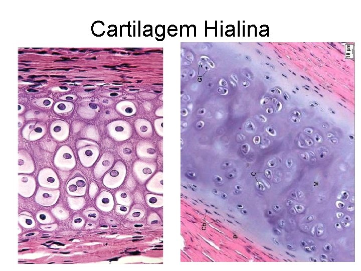 Cartilagem Hialina 