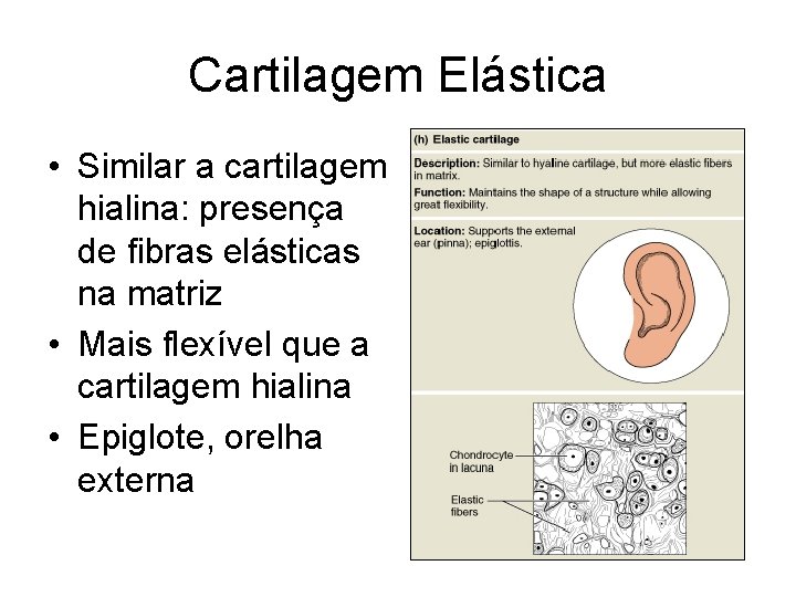 Cartilagem Elástica • Similar a cartilagem hialina: presença de fibras elásticas na matriz •
