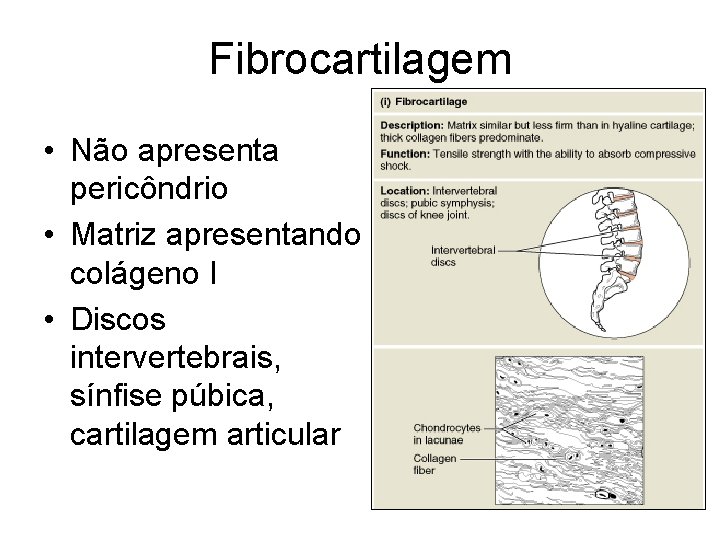 Fibrocartilagem • Não apresenta pericôndrio • Matriz apresentando colágeno I • Discos intervertebrais, sínfise