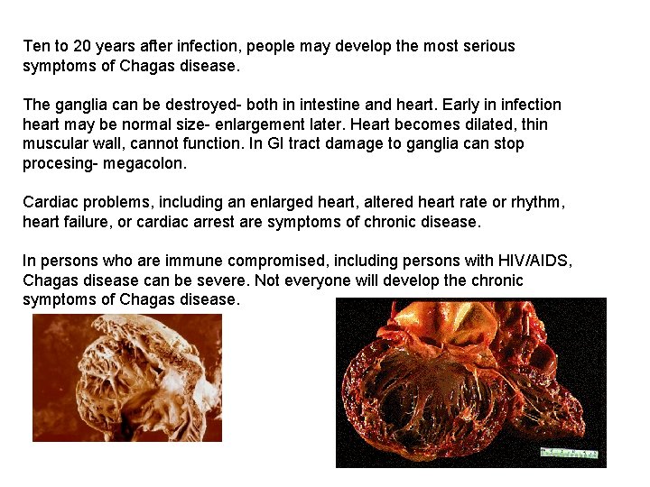 Ten to 20 years after infection, people may develop the most serious symptoms of