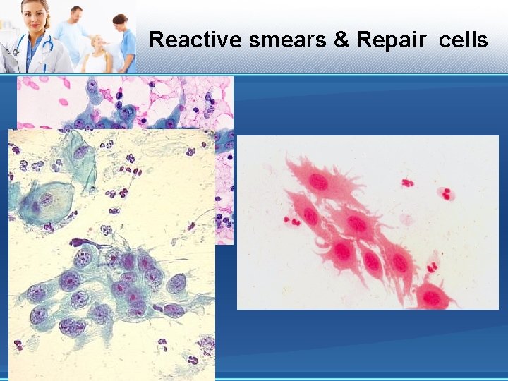 Reactive smears & Repair cells 