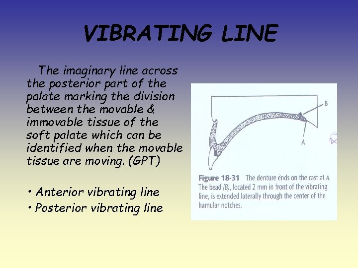 VIBRATING LINE The imaginary line across the posterior part of the palate marking the