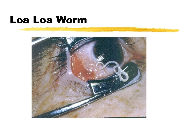 Loa Worm 