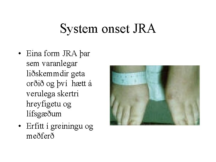 System onset JRA • Eina form JRA þar sem varanlegar liðskemmdir geta orðið og