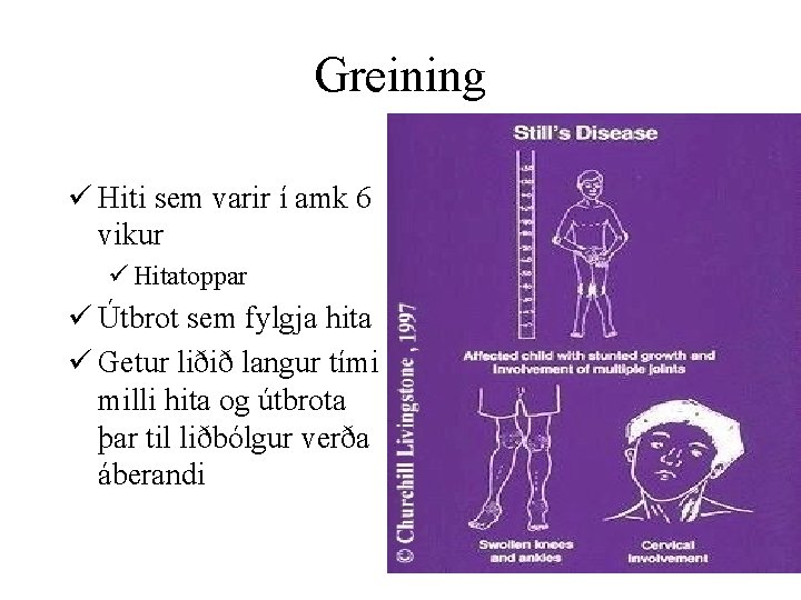 Greining ü Hiti sem varir í amk 6 vikur ü Hitatoppar ü Útbrot sem