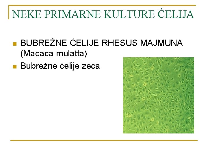 NEKE PRIMARNE KULTURE ĆELIJA n n BUBREŽNE ĆELIJE RHESUS MAJMUNA (Macaca mulatta) Bubrežne ćelije