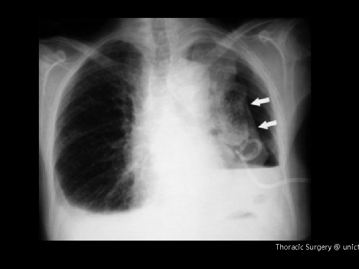 Thoracic Surgery @ unict 