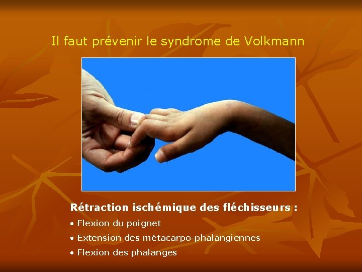 Il faut prévenir le syndrome de Volkmann Rétraction ischémique des fléchisseurs : • Flexion