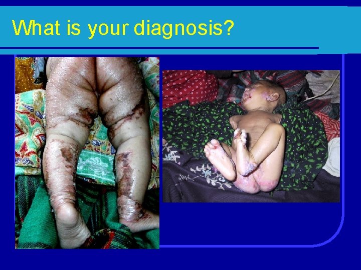 What is your diagnosis? 