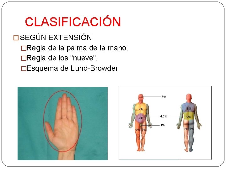 CLASIFICACIÓN � SEGÚN EXTENSIÓN �Regla de la palma de la mano. �Regla de los